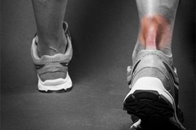 Dealing With a Torn Achilles Tendon